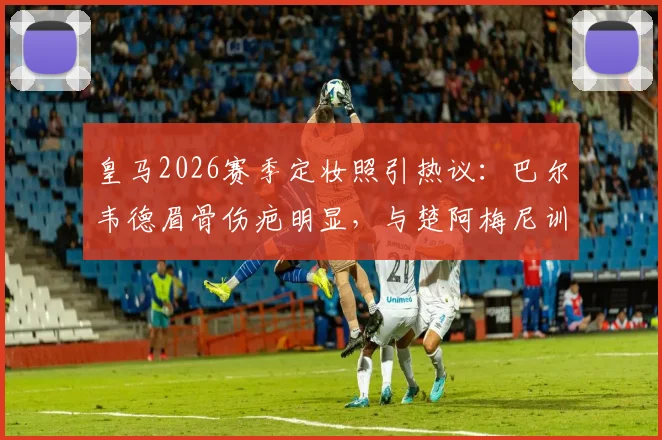 皇马2026赛季定妆照引热议：巴尔韦德眉骨伤疤明显，与楚阿梅尼训练冲突细节回顾